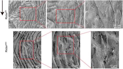 Rictor maintains endothelial integrity under shear stress